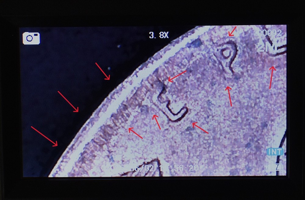 1949 D Penny Error Red Mint State Multi Error Double Die, Cracks Collar Filled D