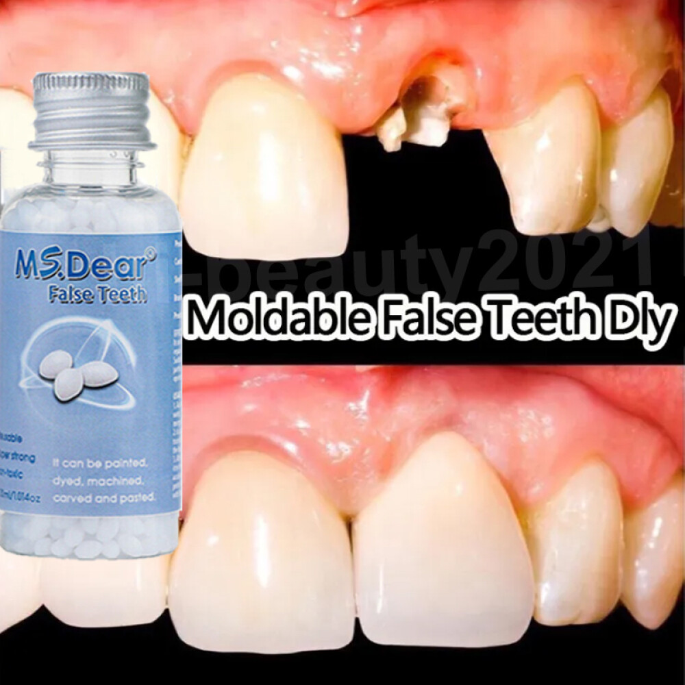 Tooth Repair Granules Temporary Kit Fitting Beads Reusable Moldable False Teet