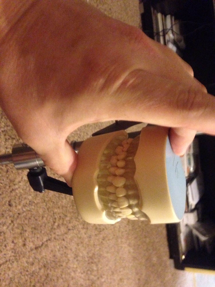 Dental Typodont Mounted On A Pole