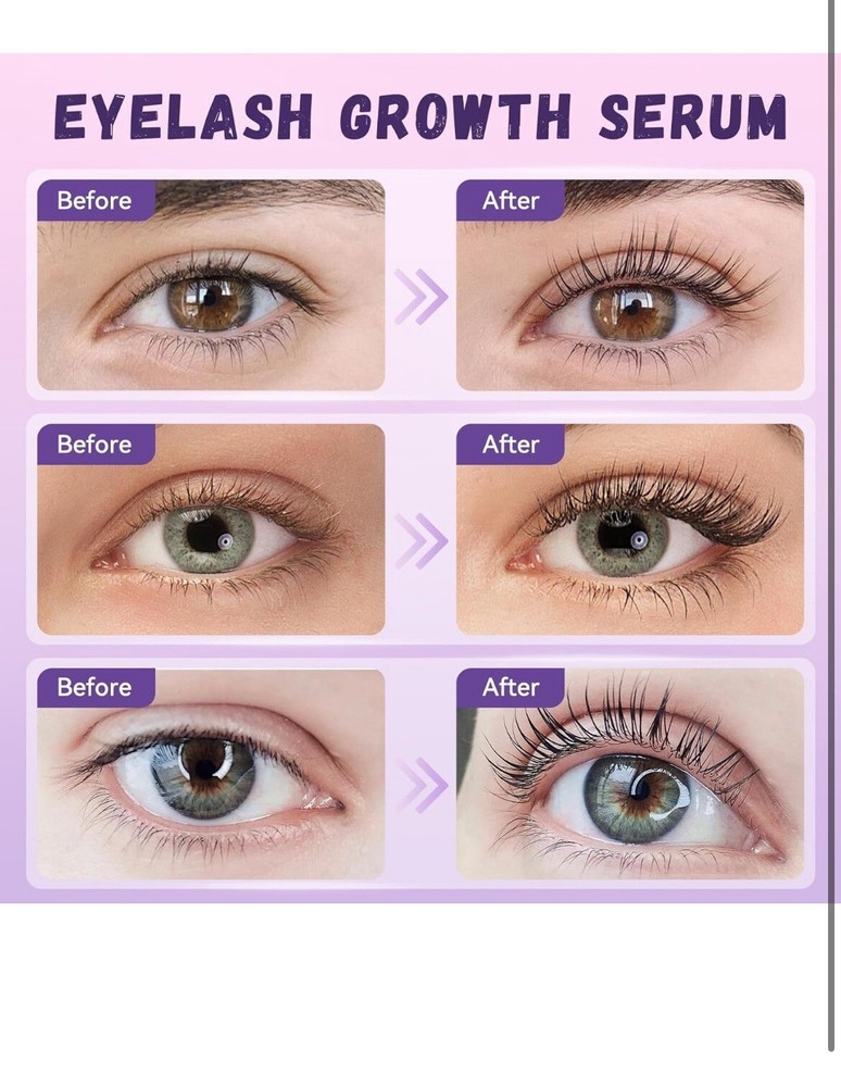 Eyelash Growth Serum