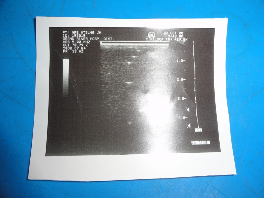 Sonora ARS AT5L40 / ATL 5.0 HRS Linear Array Replacement Transducer ~ 8935