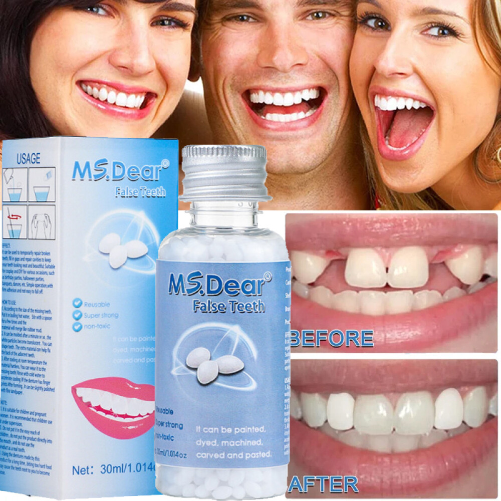Tooth Repair Kit - Temporary Teeth Replacement Kit for Missing & Broken Teeth