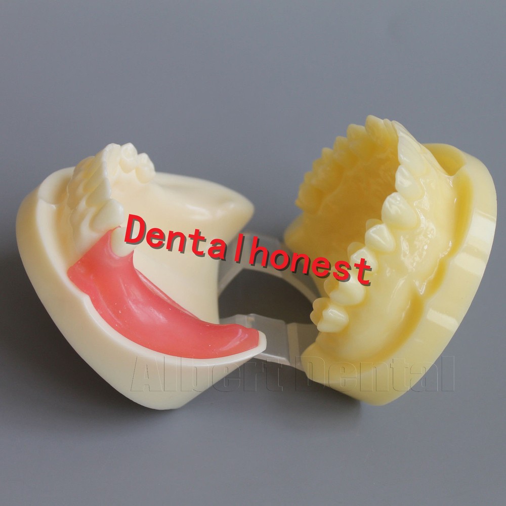 Great Dental Full Implant Drilling Practice Teeth Study Model Typodont Model
