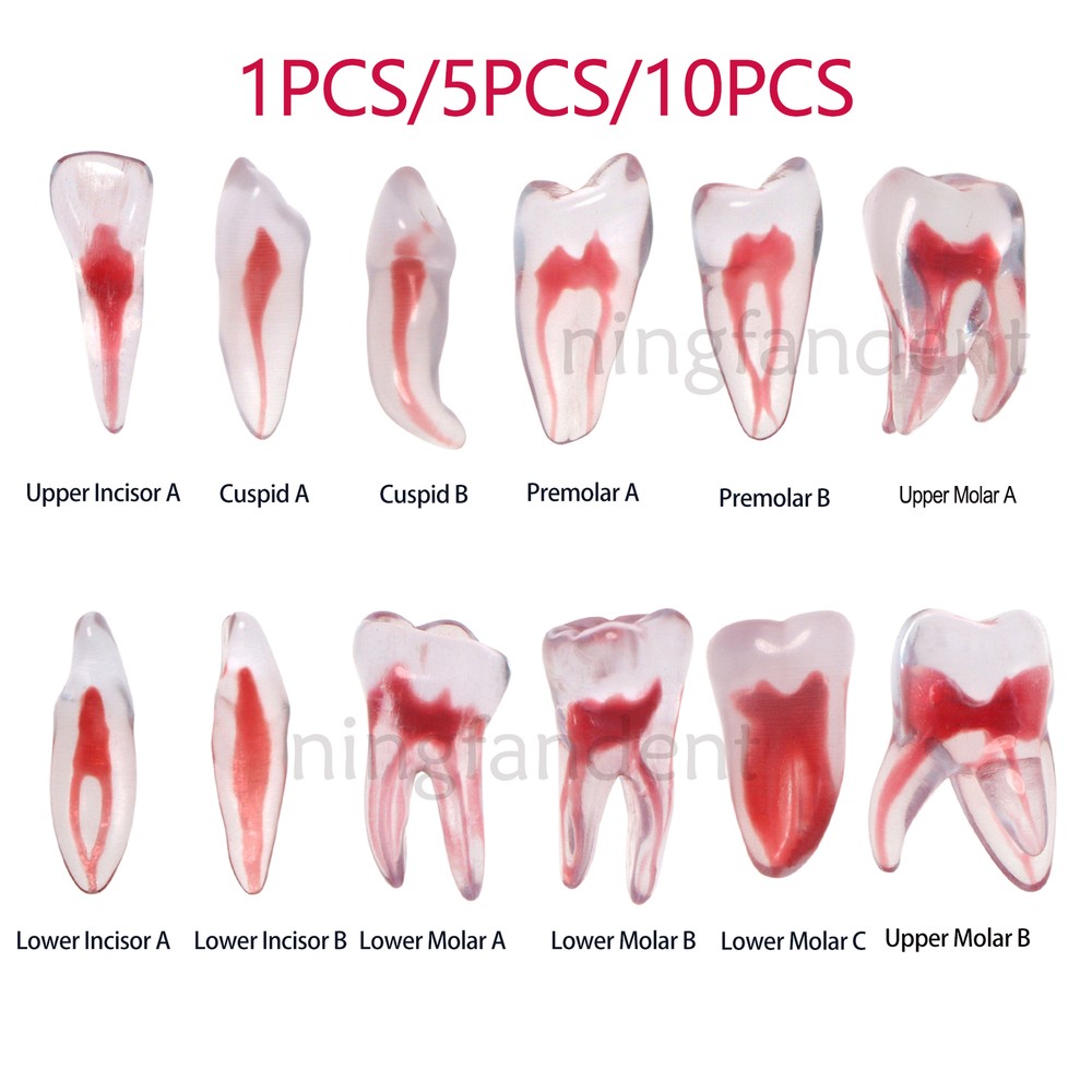 Dental Endo Root Canal Teeth Model Practice Block for RCT Pulp Cavity Study, 3D