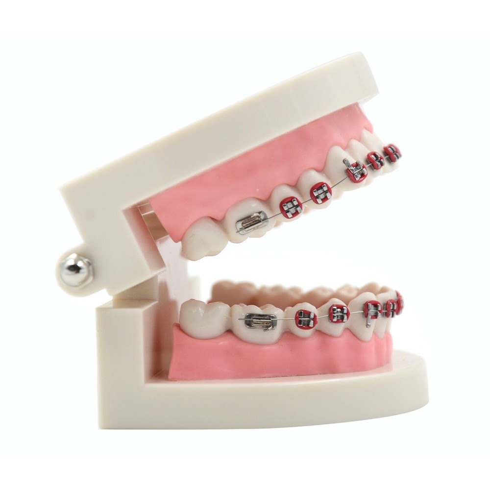 Dental Teach Typodont Demonstration Teeth Model with Braces For Patient Study