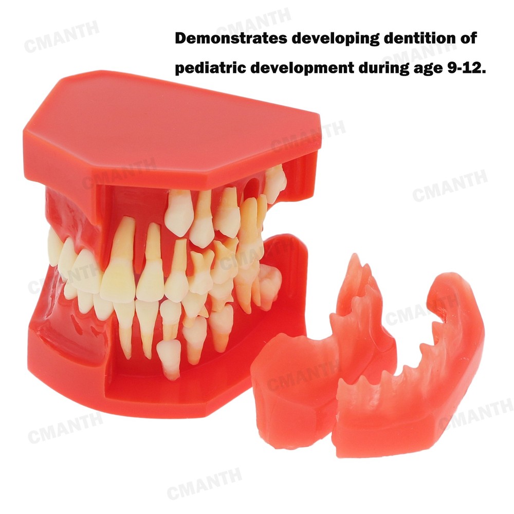 Dental Pediatric Teeth Development Model Detachable Alternate Demo Teach Model