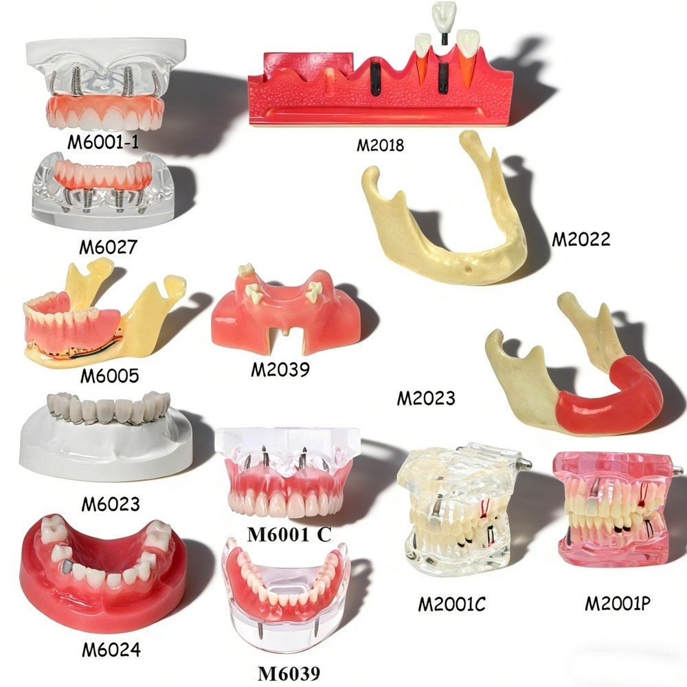 Implant Practice Demo Multiple Types Dental Teaching Teeth Model Typodont Ortho