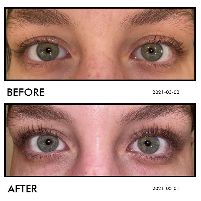 Lash & Brow Serum: Seductive Lashes Best Lash Serum