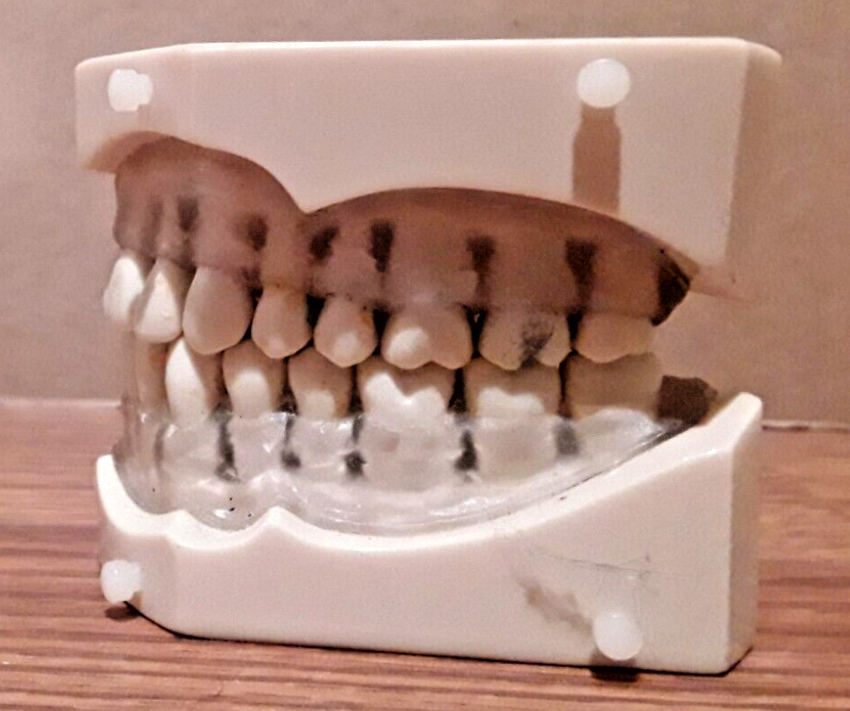 Columbia Dentoform R861 Dental Typodont Model 32pcs Removable Teeth.