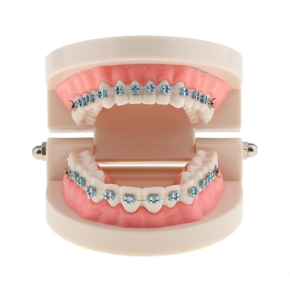 Dental Teach Typodont Demonstration Teeth Model with Braces For Patient Study