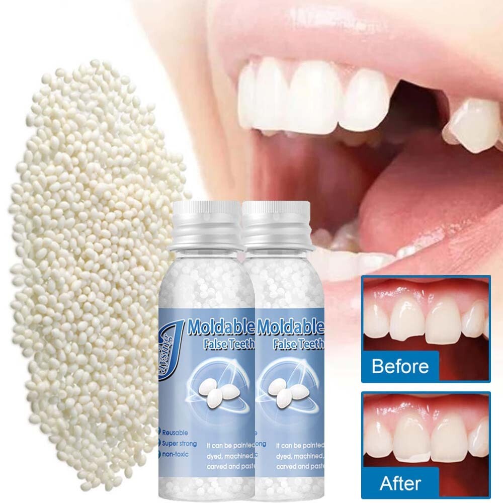 2X Tooth Repair Kit - Temporary Teeth Replacement Kit for Missing & Broken Teeth