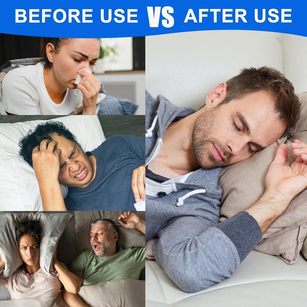 Universal-Fit 60 Count Nasal Strips: Soft, Lightweight Solution for Better Sleep