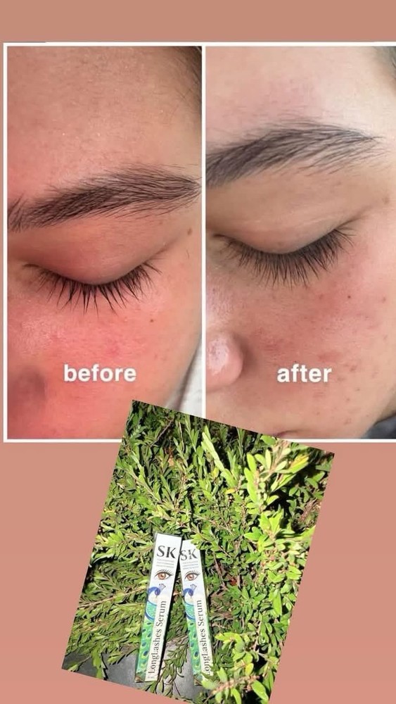 SK Long Lashes Serum សេរ៉ូមបណ្តុះរោមភ្នែក រោមចិញ្ចើម អោយវែង ( 1B / 5ml )