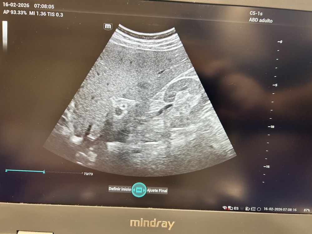 Mindray C5-1S Convex Array Probe for Ultrasound, Tested