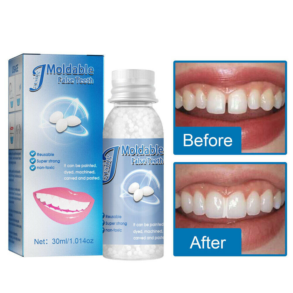 3×Resin False Teeth Solid Glue Temporary Tooth Repair Moldable Teeth Gap Denture