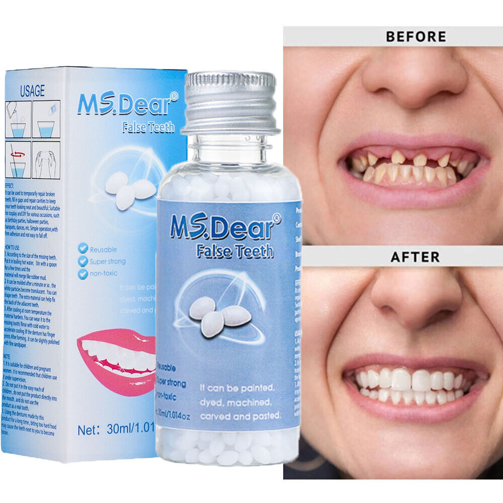 3/1x Tooth Repair Granules Temporary Reusable Moldable False Teeth Fitting Beads