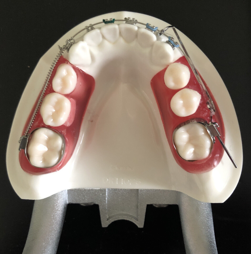 Nissin Ortho Typodont Dental Model