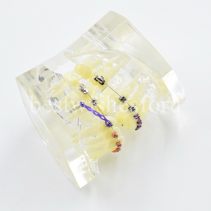 Dental Malocclusion Treatment Teeth Model Study Typodont Elastic chain 3005-2