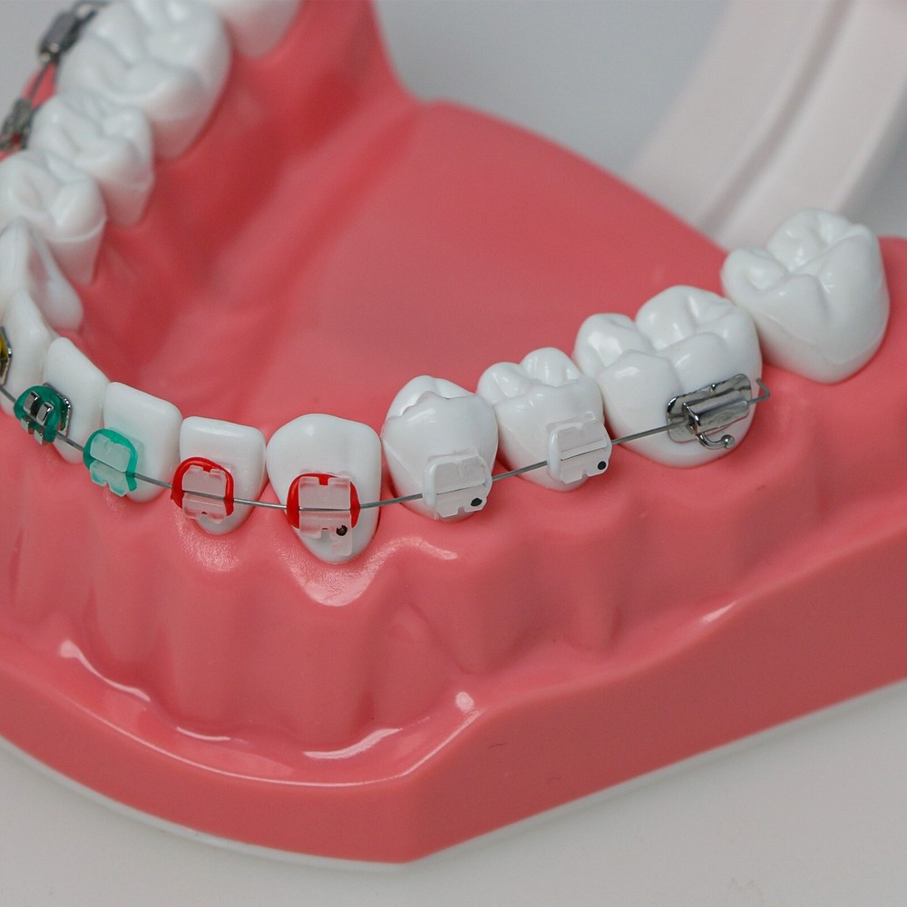 Dental Typodont Teeth 1:1 Teach Study Model Half Metal Ceramic Brackets Tubes