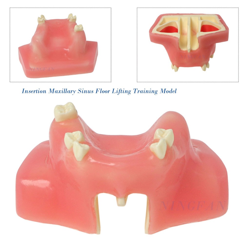 Dental Implant Practice Model, Lower Jaw Drilling, Maxillary Sinus Lifting Type