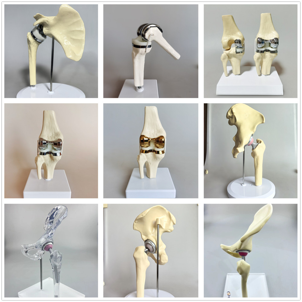 Artificial Shoulder Replacement Anatomical Model Knee Shoulder Elbow Joint Model