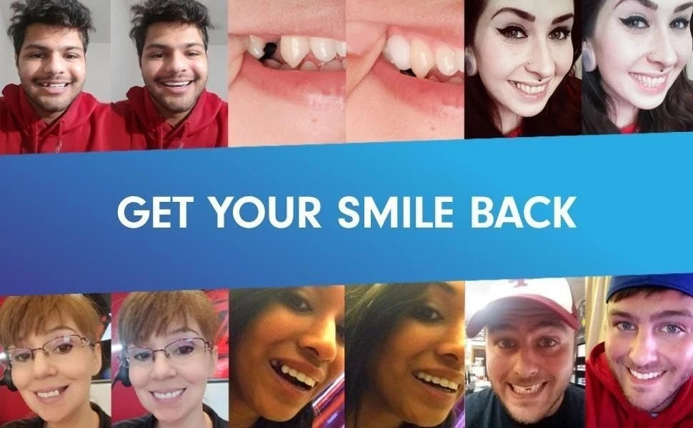 Complete DIY Temporary Tooth Replacement Kit - Create Up to 10 Realistic Teeth