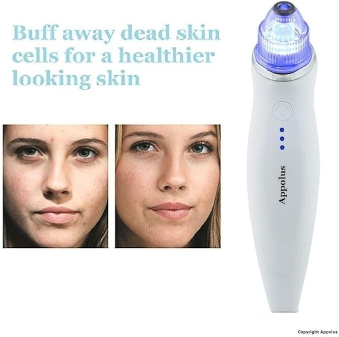 Apollus Professional Microderm with Blue Light