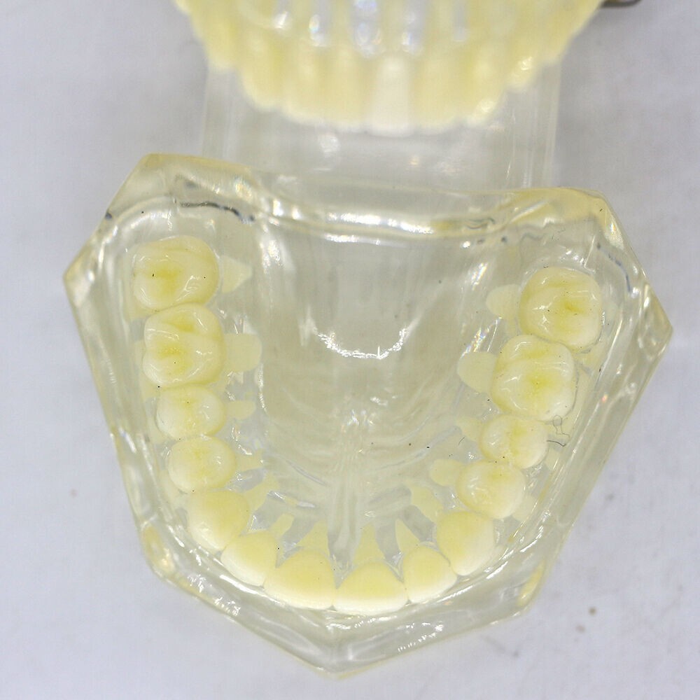 1×Transparent Plastic Study Teeth Model Demonstrate Comprehensive Repair Yellow