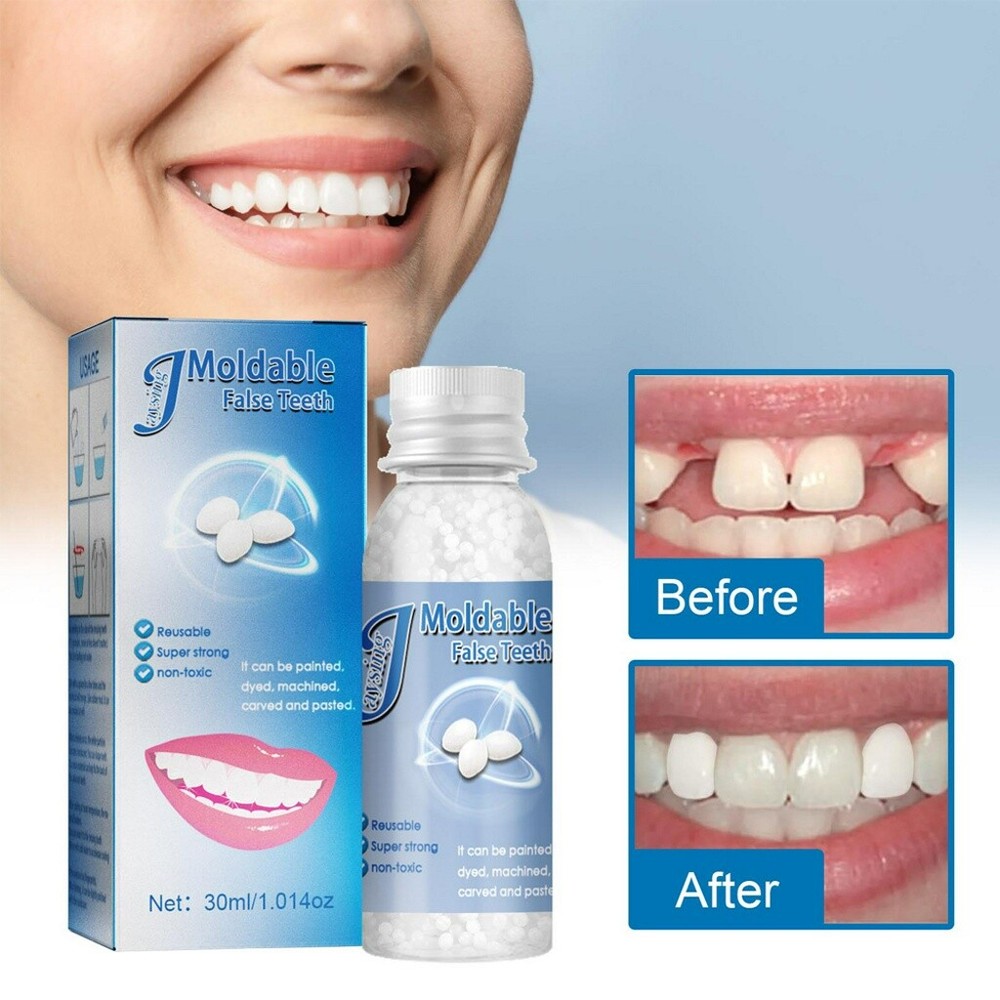 Tooth Repair Granules Temporary Kit Fitting Beads Reusable Moldable False Teeth