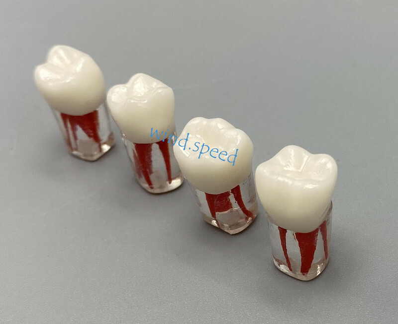 100pc Dental Root Canal Teeth Study Practice Model Endodontic RCT Endo Pulp File