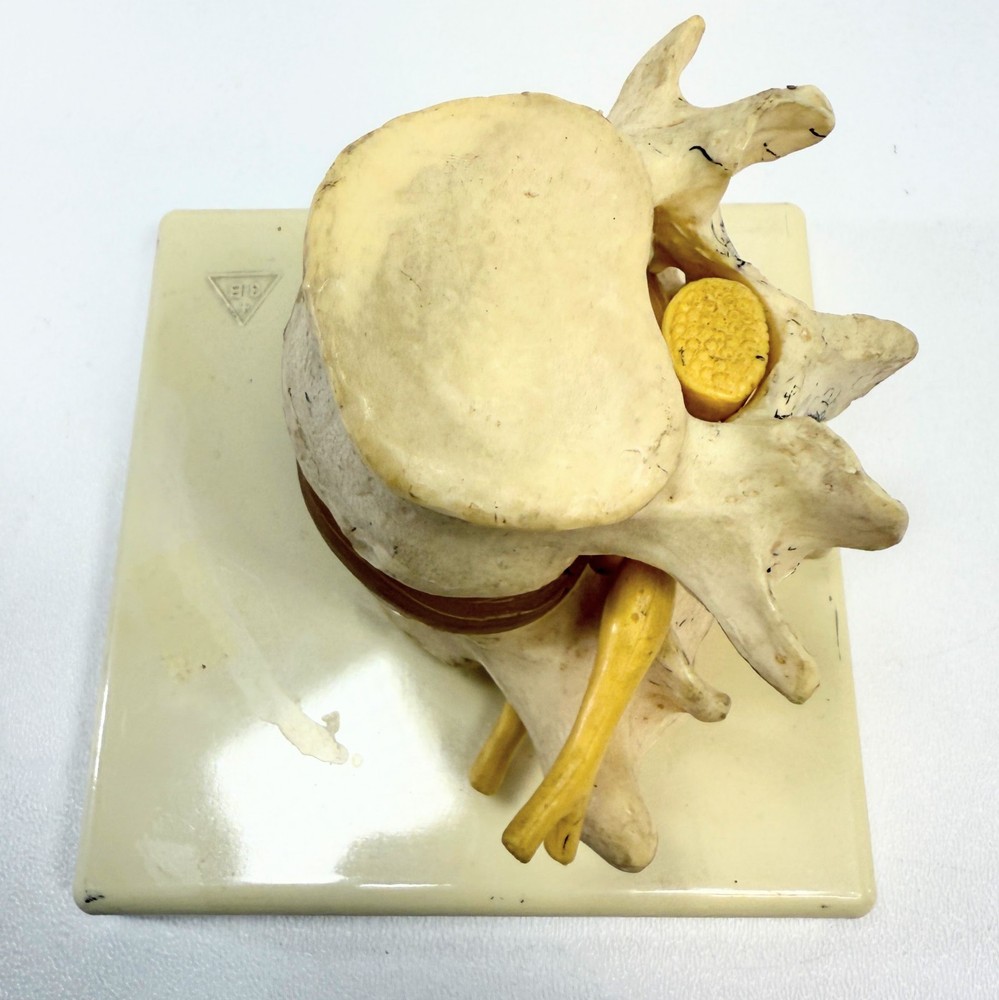 Lumber Vertibrae Model with Disc on Stand