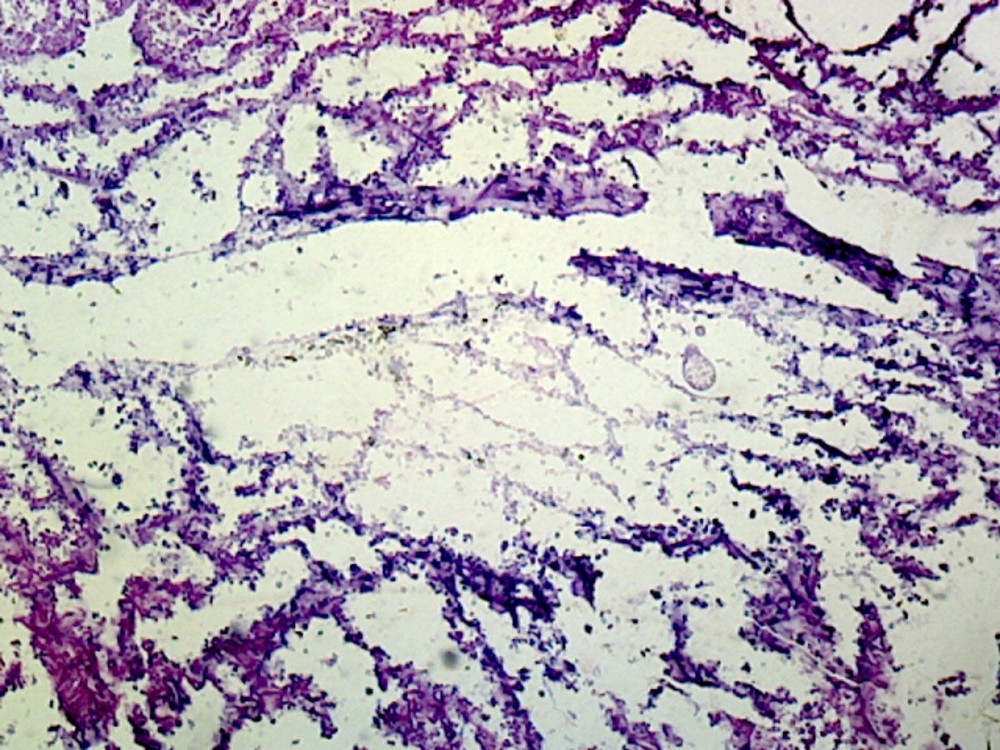 Grantia (Scypha); Longitudinal Section