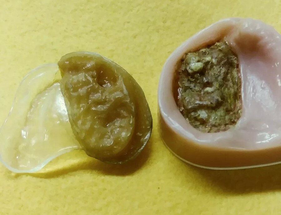 Cleft Palate DENTAL LAB DEMONSTRATION TEACHING MODEL  Lab. Dentist ODD RARE