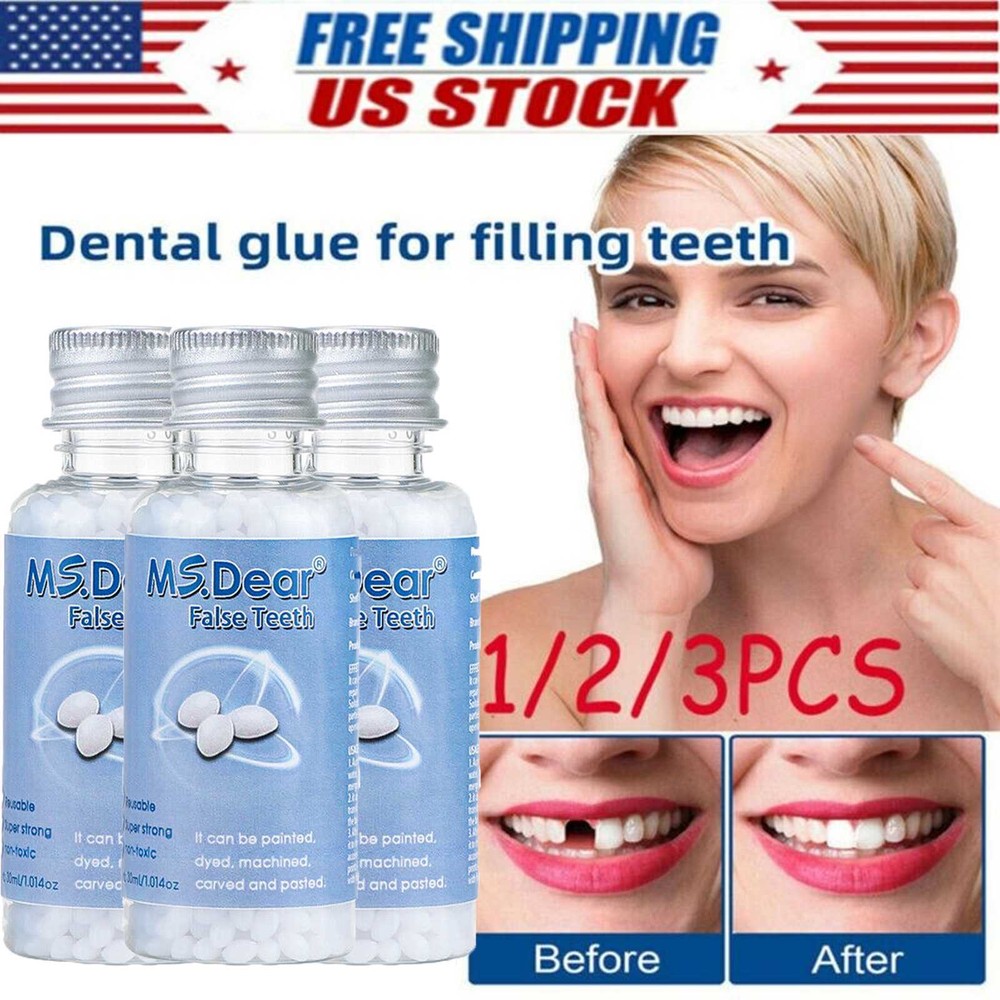 Tooth Repair Granules Temporary Kit Fitting Beads Reusable Moldable False Teeth
