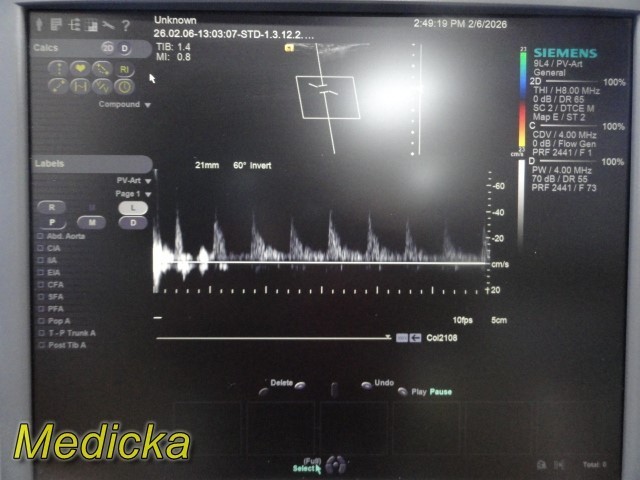 2013 Siemens 9L4 Linear Array Ultrasound Transducer Ref 10035946 ~ 39512