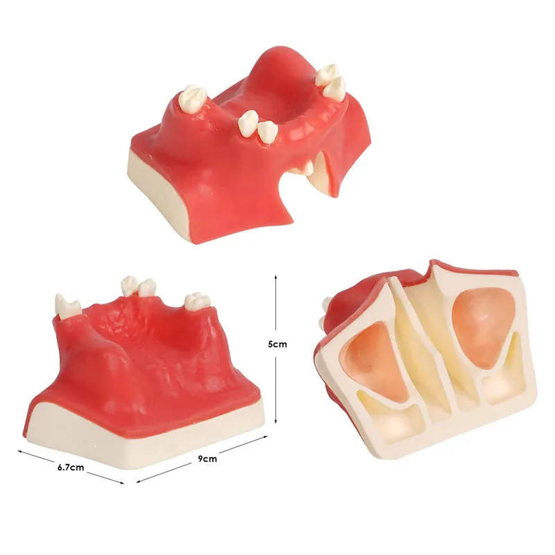 Maxillary Sinus Teeth Model Dental Teaching Model for Student Practice Studying