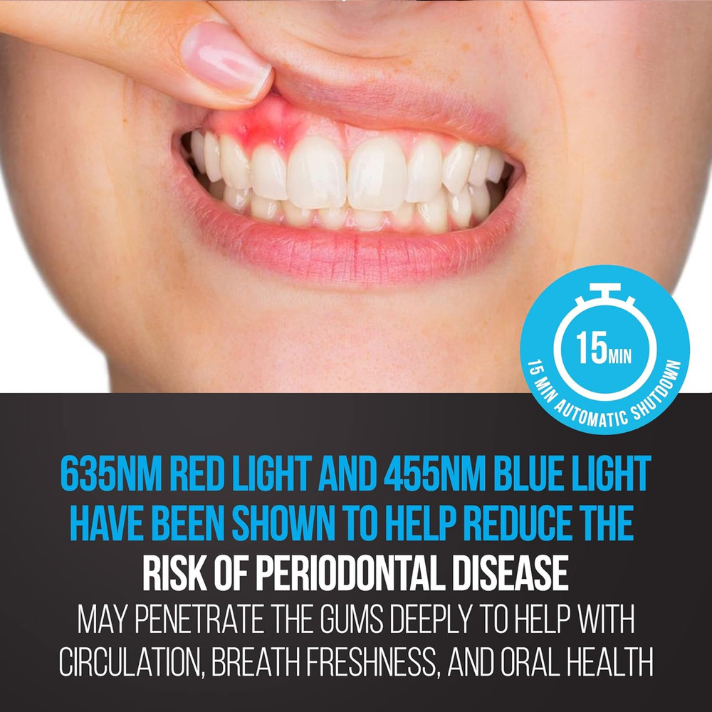 LED Red Blue Teeth Whitening Light Gum Support Device