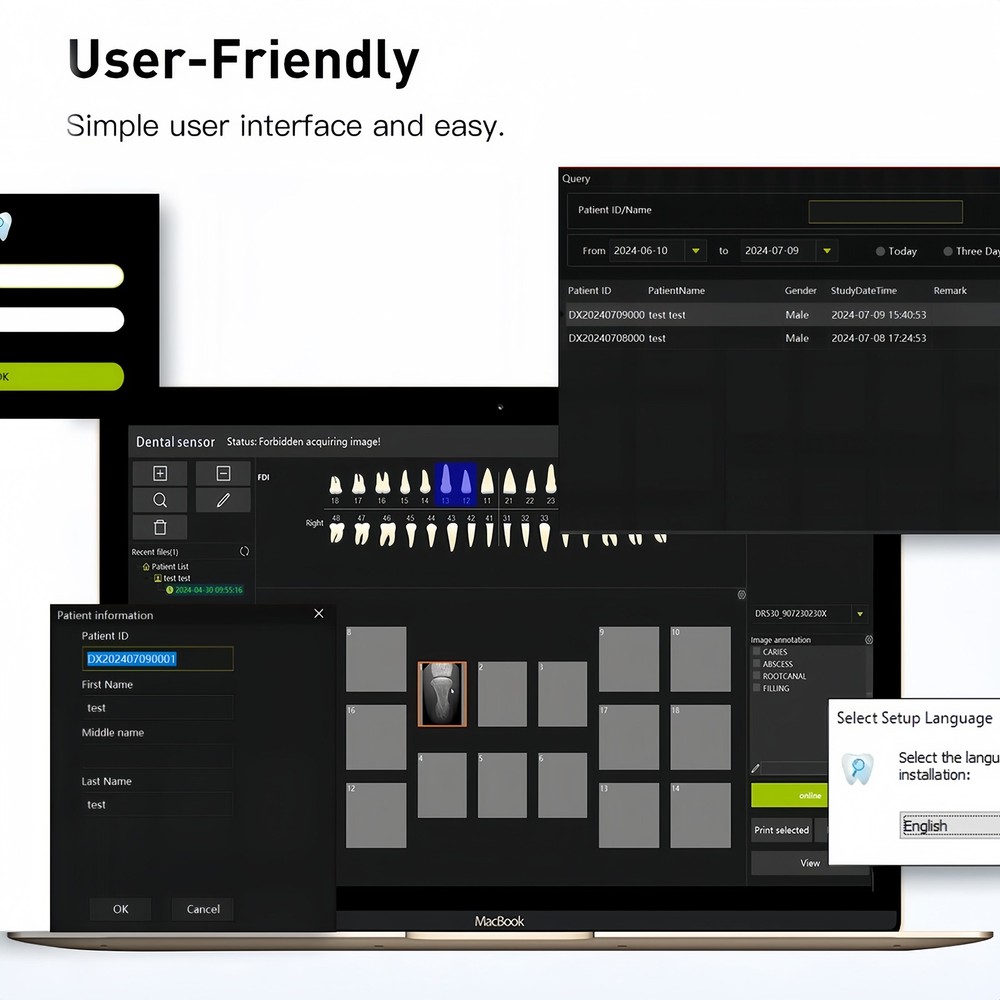 Dental Sensor Size 1.5 || Fast ship || Twain
