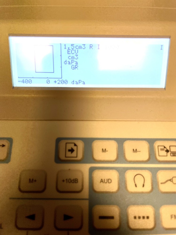GSI 39