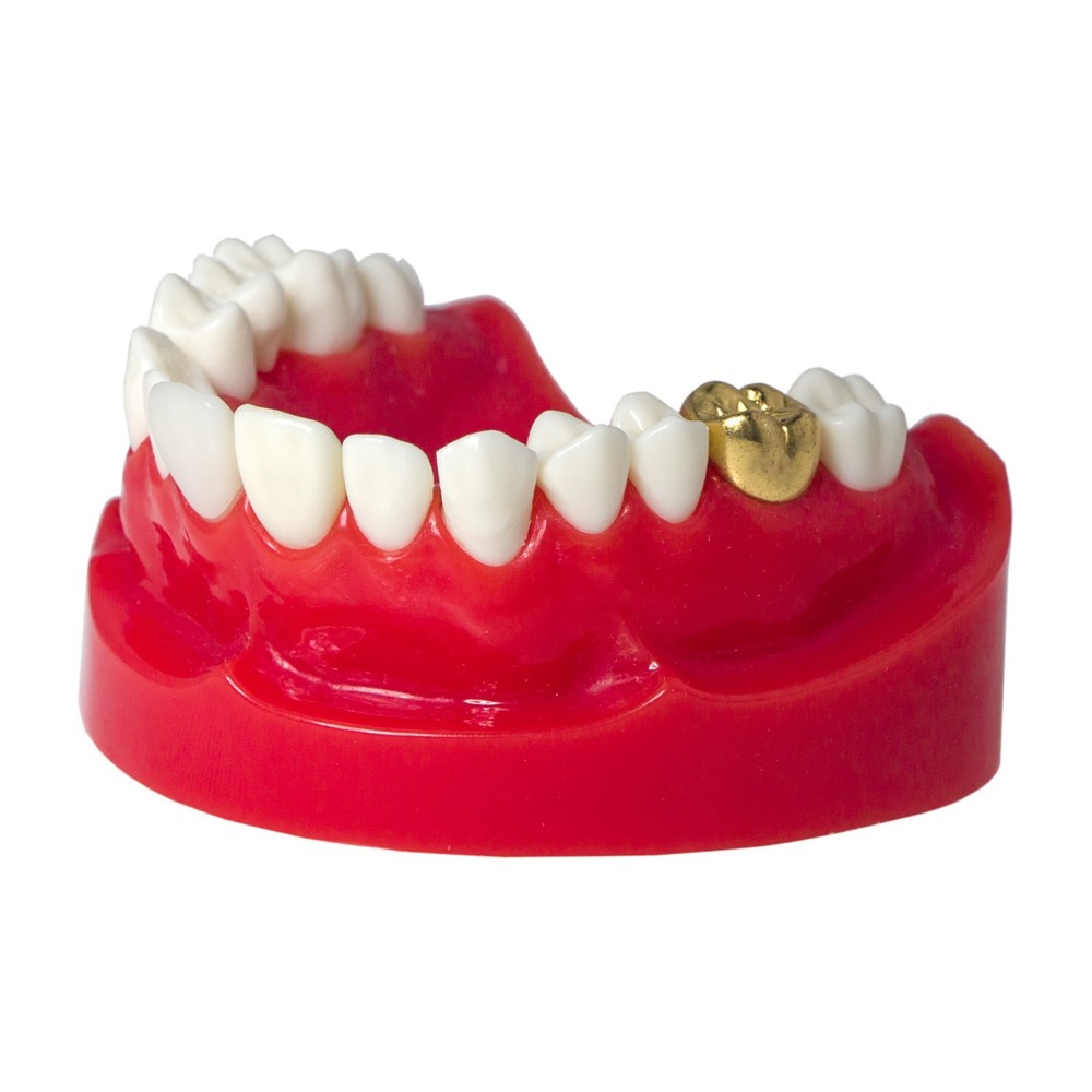Dental M6004 Teaching Typodont Restoration Teeth Model Crown Post Core Bridge