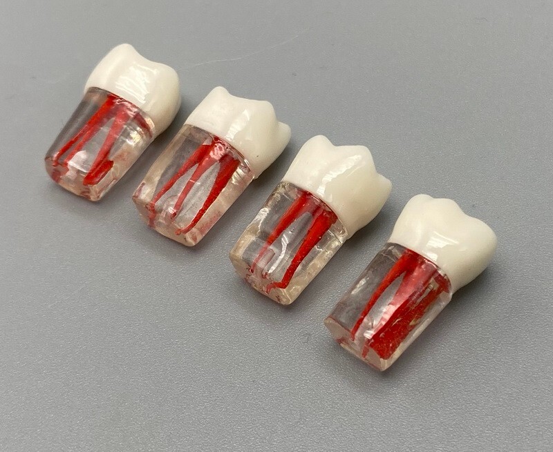 5pcs Dental Root Canal Teeth Study Practice Model Endodontic RCT Endo Pulp File