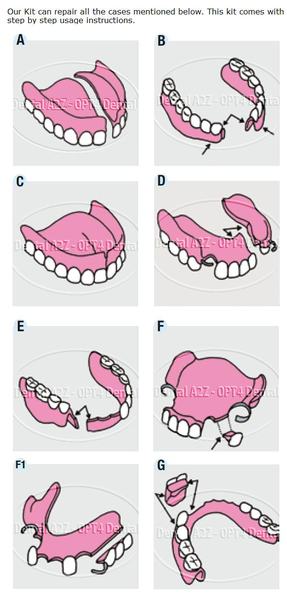 Complete Professional Denture Repair Kit with teeth