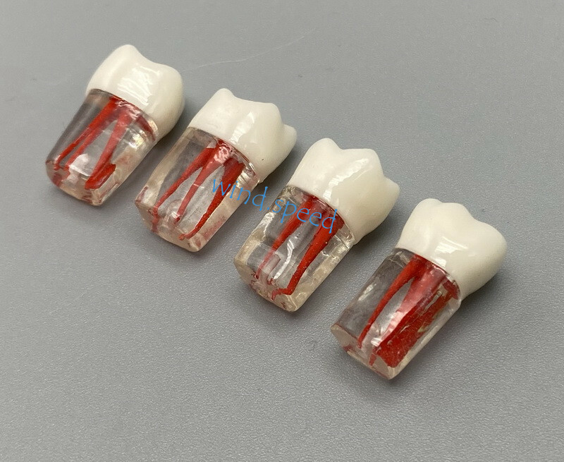 100pc Dental Root Canal Teeth Study Practice Model Endodontic RCT Endo Pulp File