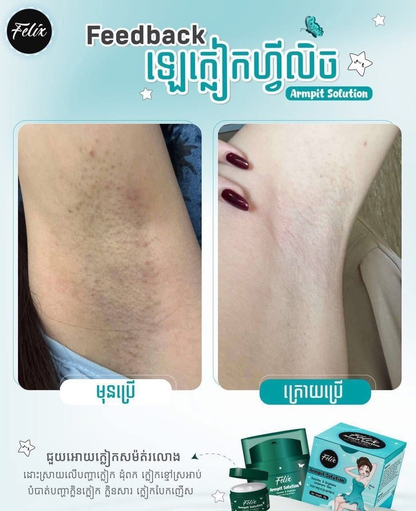 Felix Armpit Solution Cream លេលាបក្លៀកសរ ( 18g )