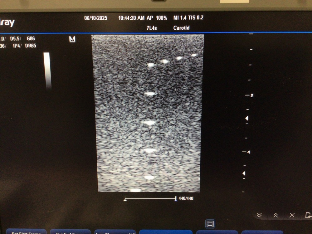 2012 Mindray 7L4s Linear Array Ultrasound Probe