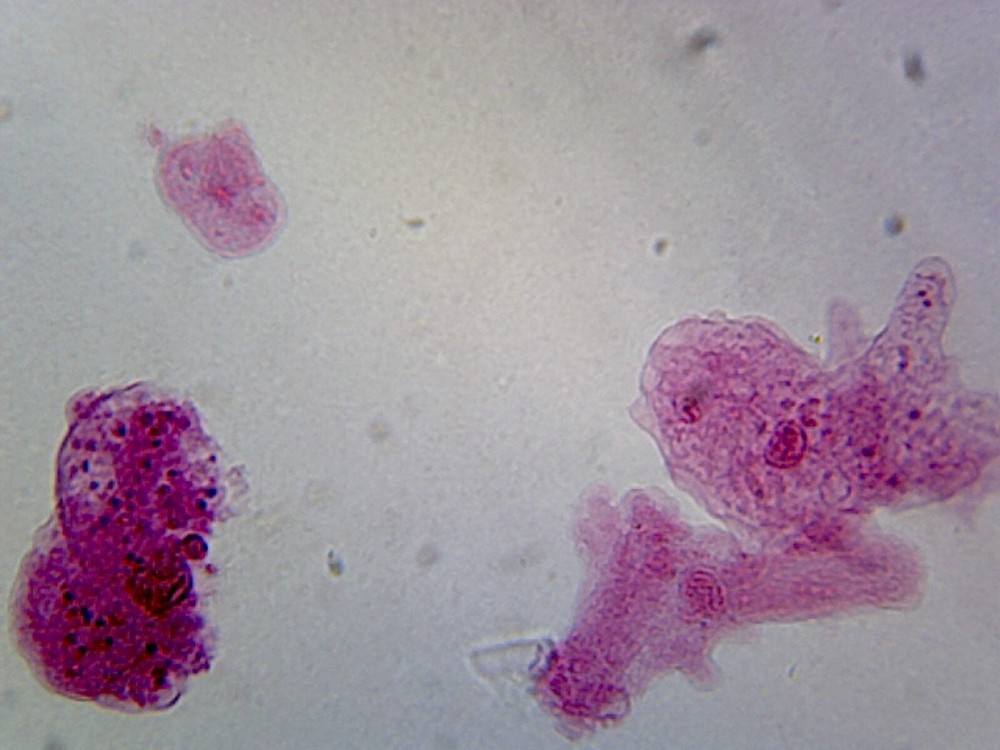 Slide, Amoeba Proteus, General Cellular Structure; Whole-mount