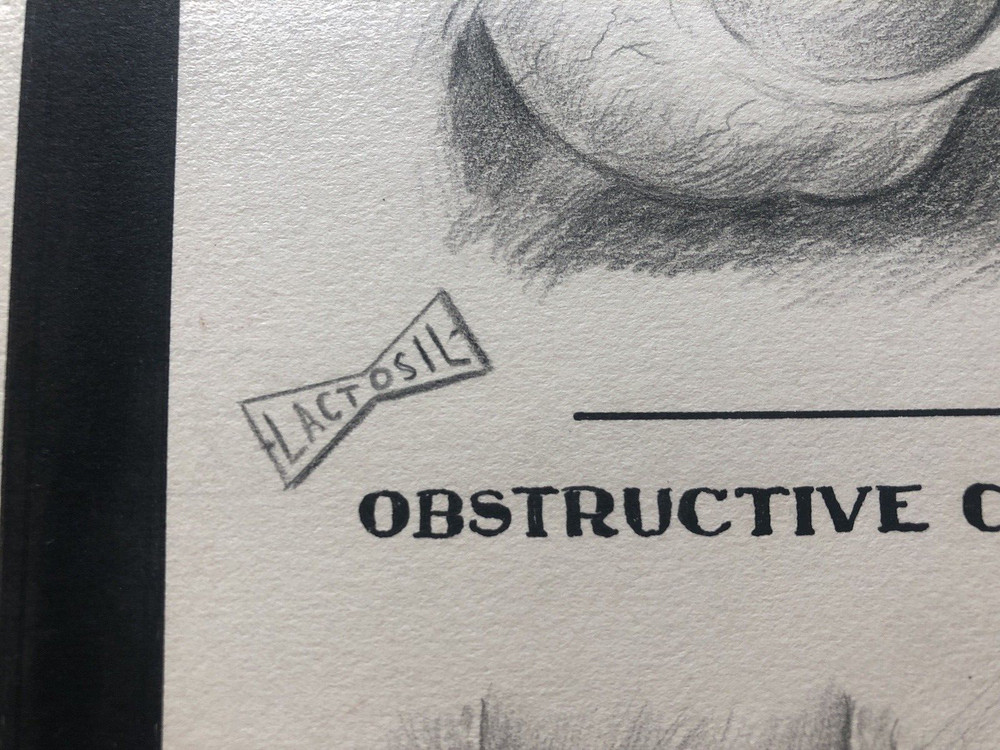 Vintage LACTOSIL Pencil Drawing Signed CONSTIPATION Appendicitis Hemorrhoids
