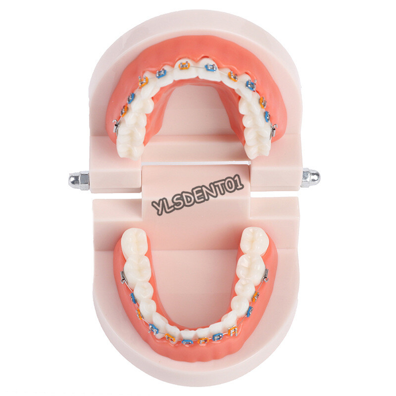 Dental Typodont Orthodontic Treatment Teeth Model Malocclusion Study w/ Bracket