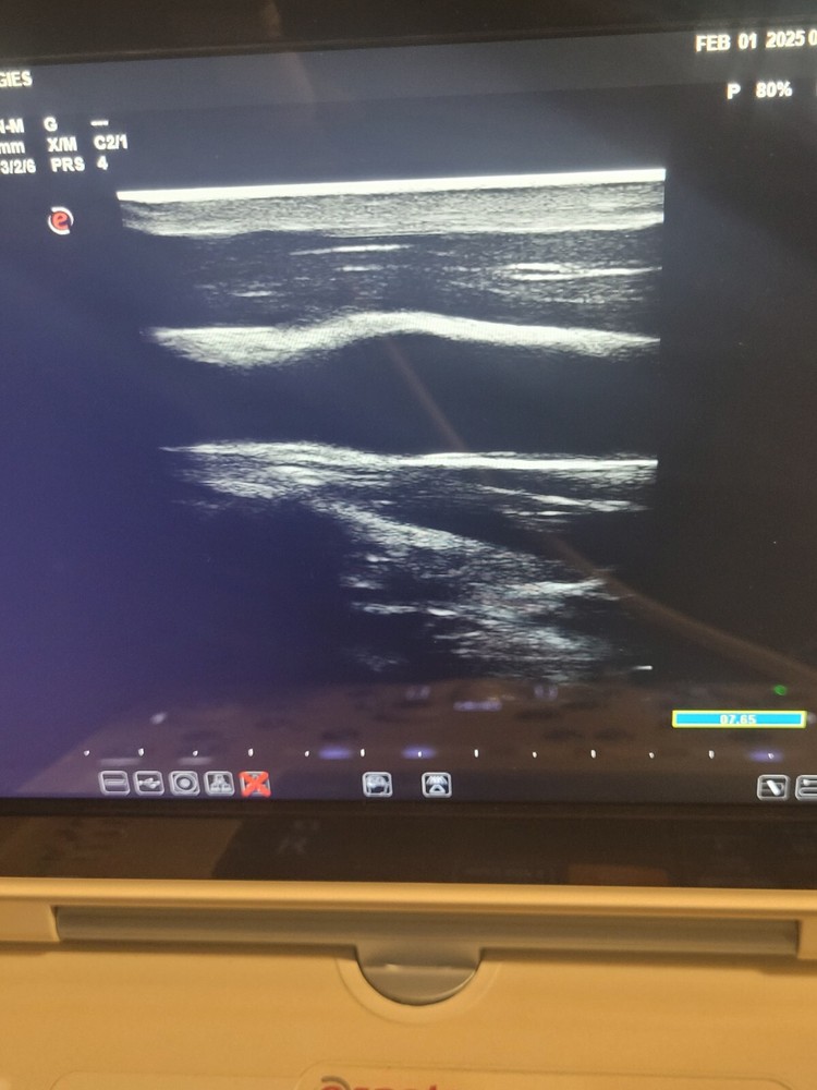 Esaote AL 2442 Linear Array Ultrasound Transducer