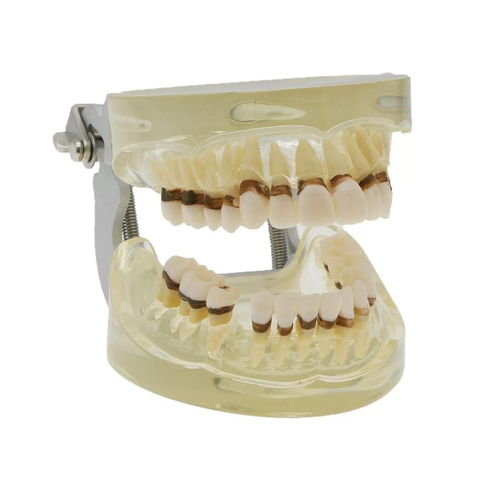 Dental Teeth Model Pathological Disease M4017 Removable Teaching Study Model